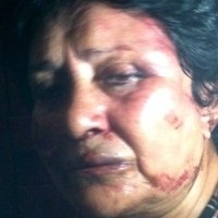 Ана Луїса Пардо Оголені