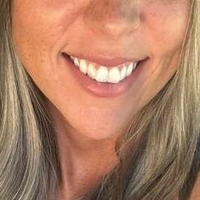 бейзболмам Оголені