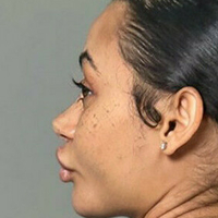 Хімайнемсті Оголені