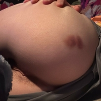 Мелонтангі Оголені