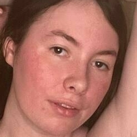 Ноанікс Фрі Оголені